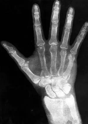 世界科学史十大“最意外发明”(图3) 世界科学史十大“最意外发明”(图3)