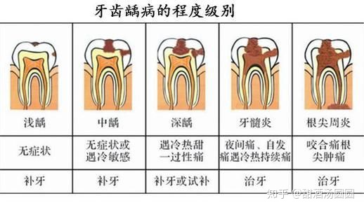 我在长沙市口腔医院补牙全过程及经验分享(图6) 我在长沙市口腔医院补牙全过程及经验分享(图6)