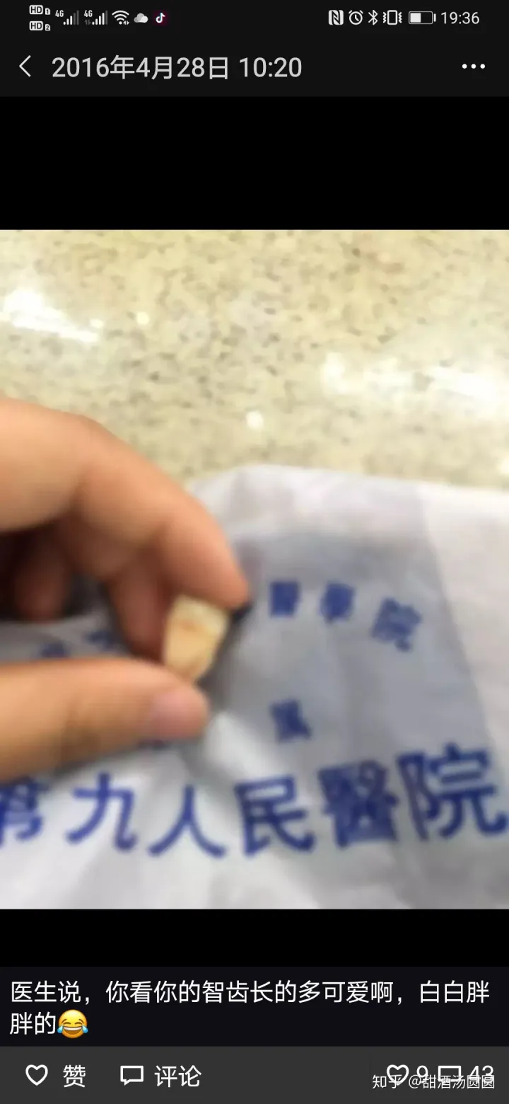 我在长沙市口腔医院补牙全过程及经验分享(图5) 我在长沙市口腔医院补牙全过程及经验分享(图5)